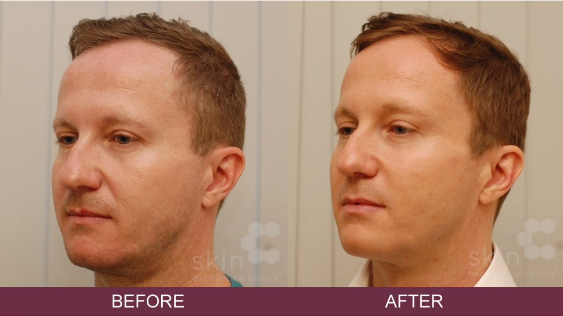 Before and after treatment.