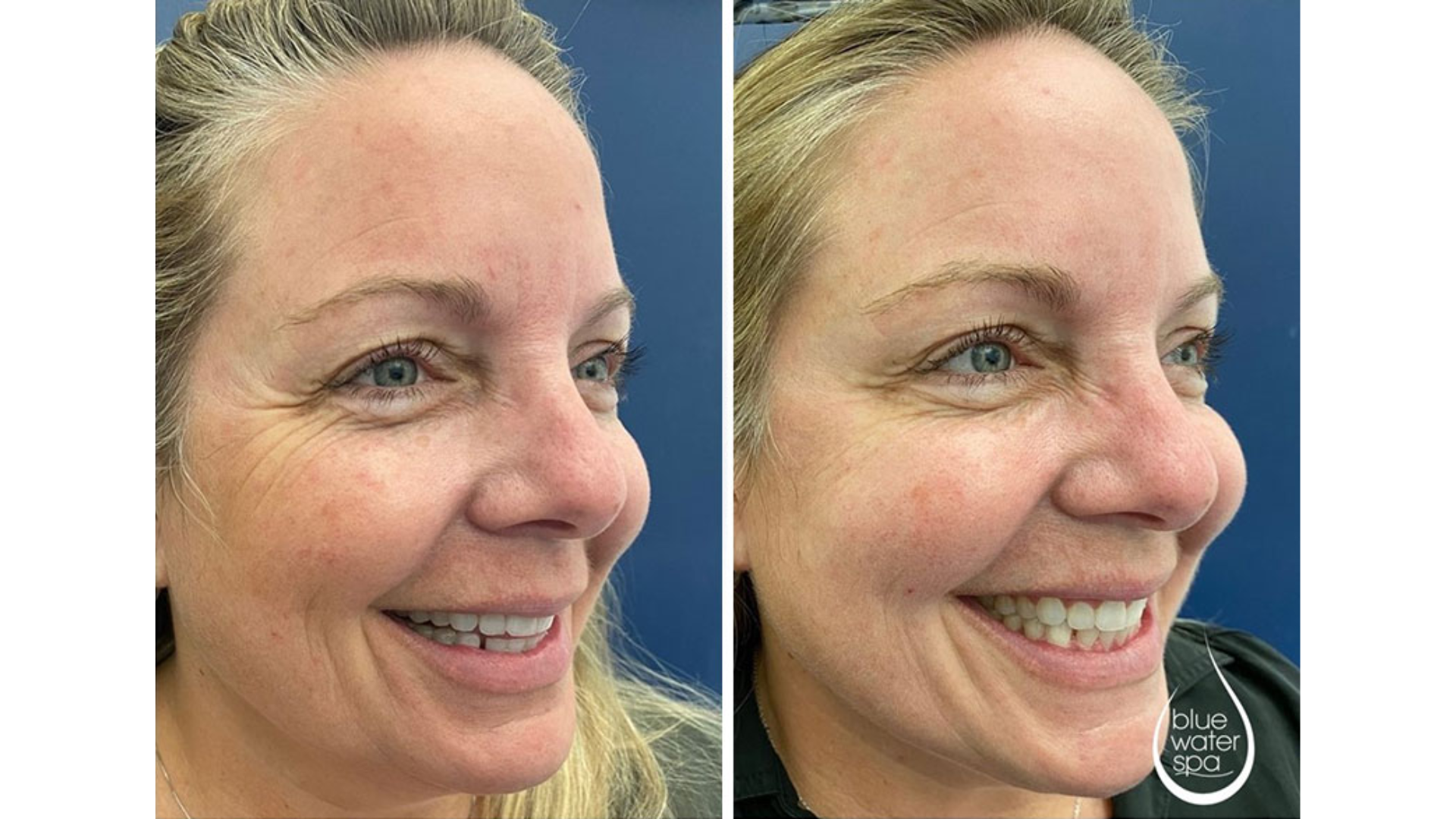 Before and after.