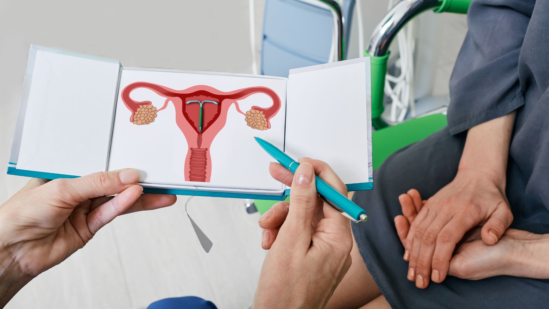 IUD. 