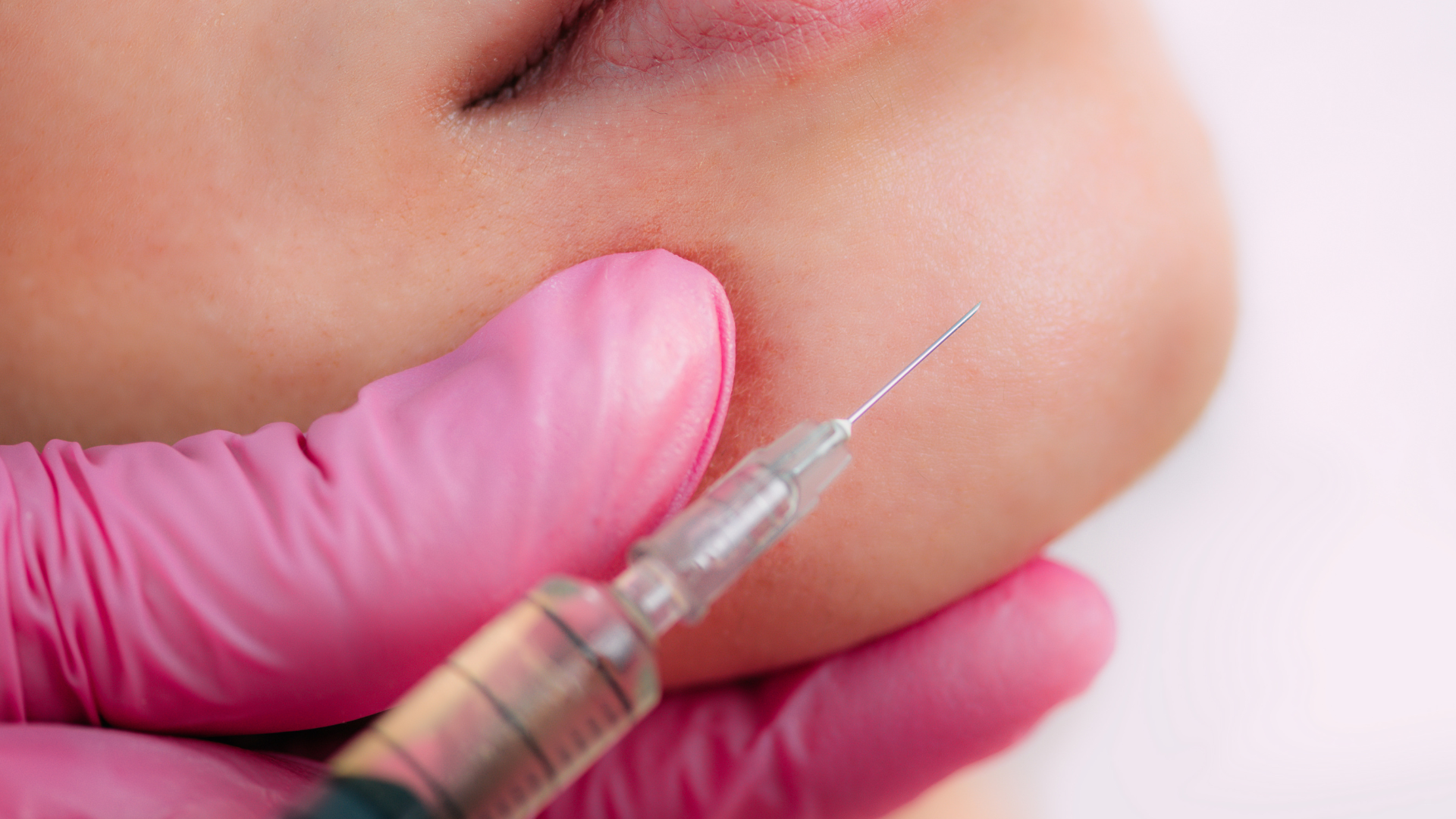 Dermal filler injection.