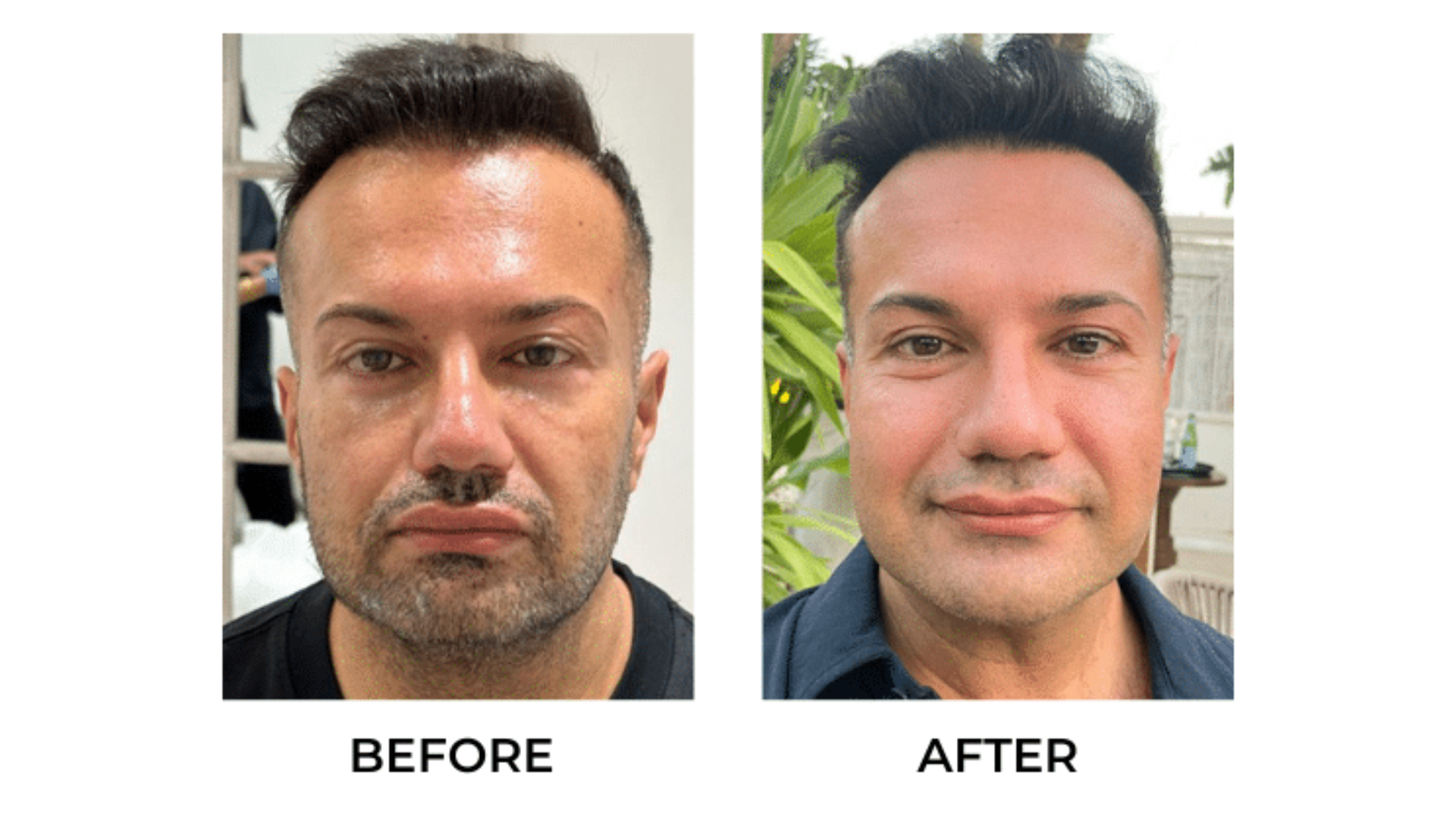 Before and after. 