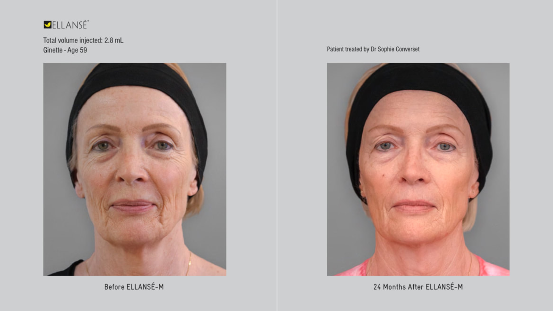 Before and after treatment.