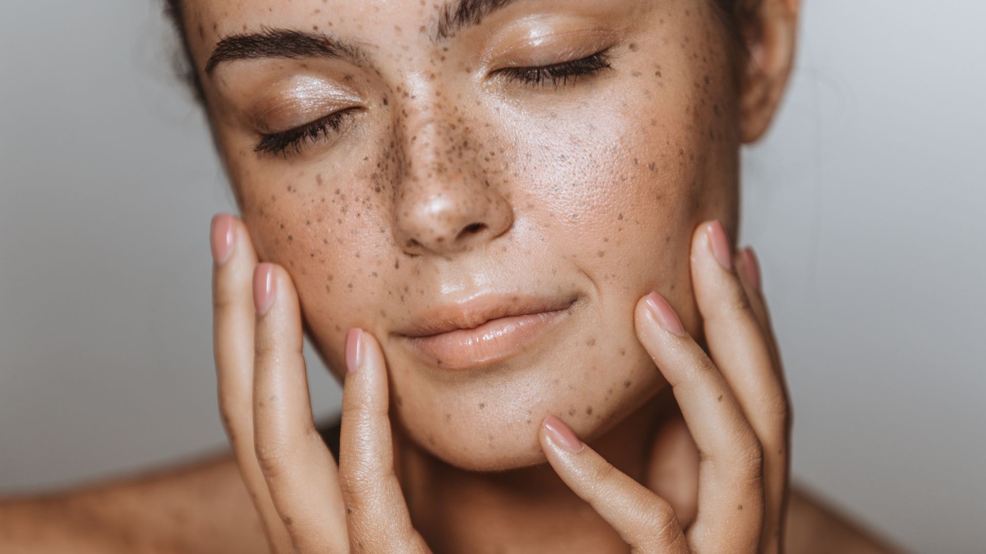 Radiessse treatment.