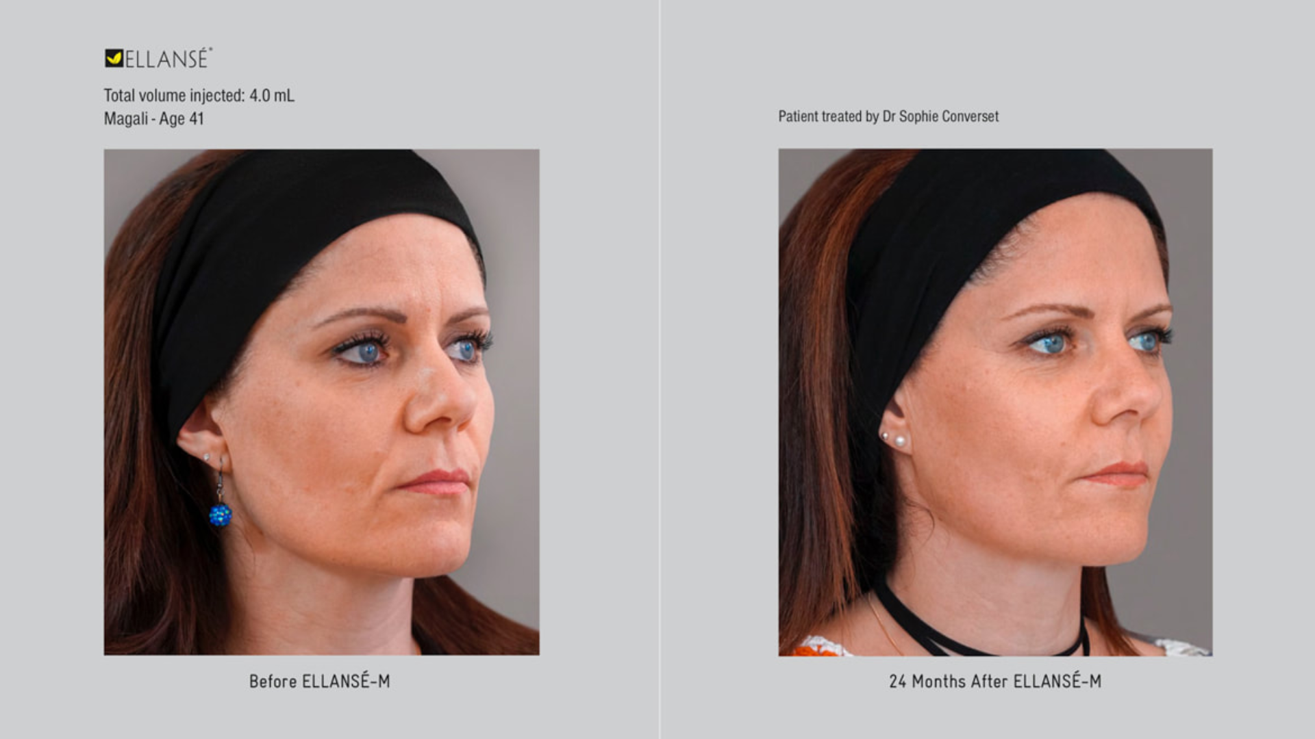 Before and after treatment.