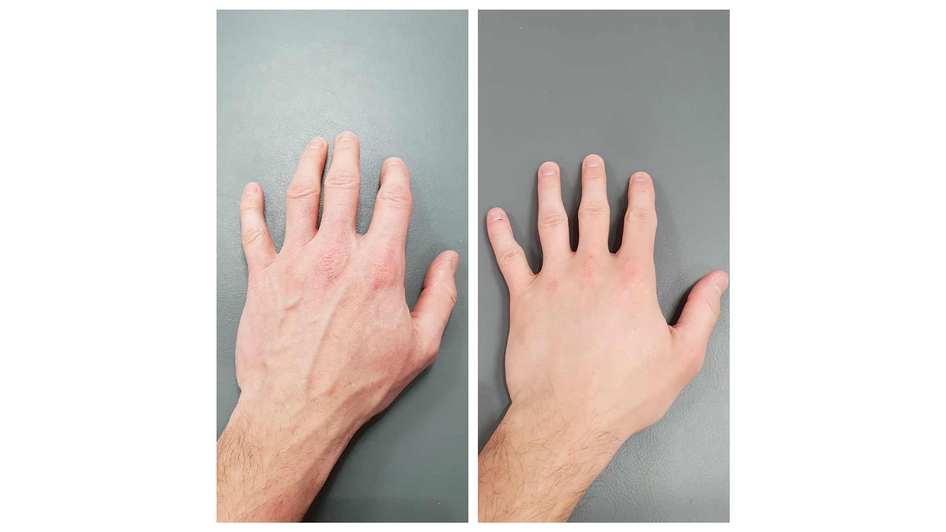 Before and after of treatment.