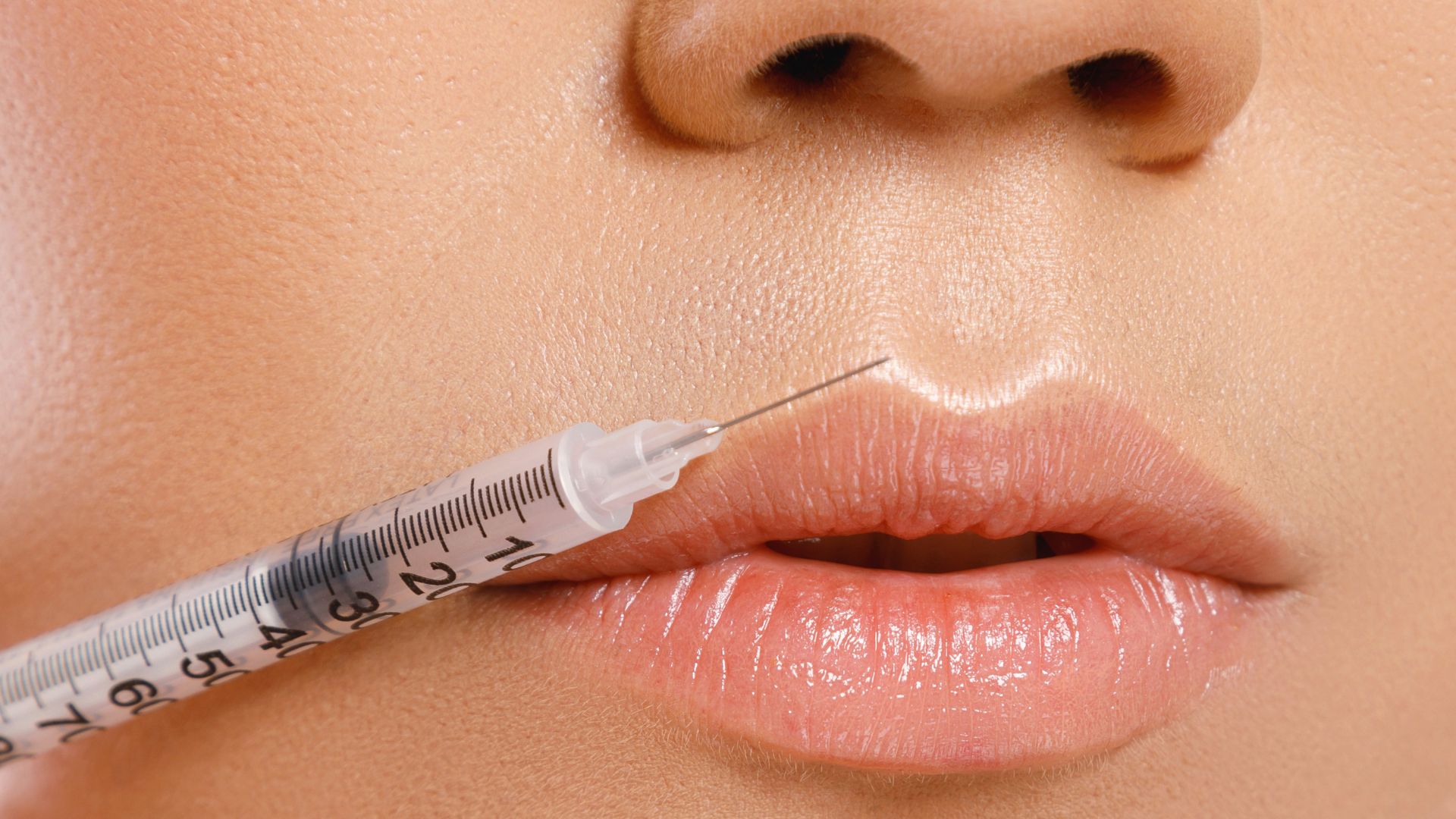 Dermal fillers.