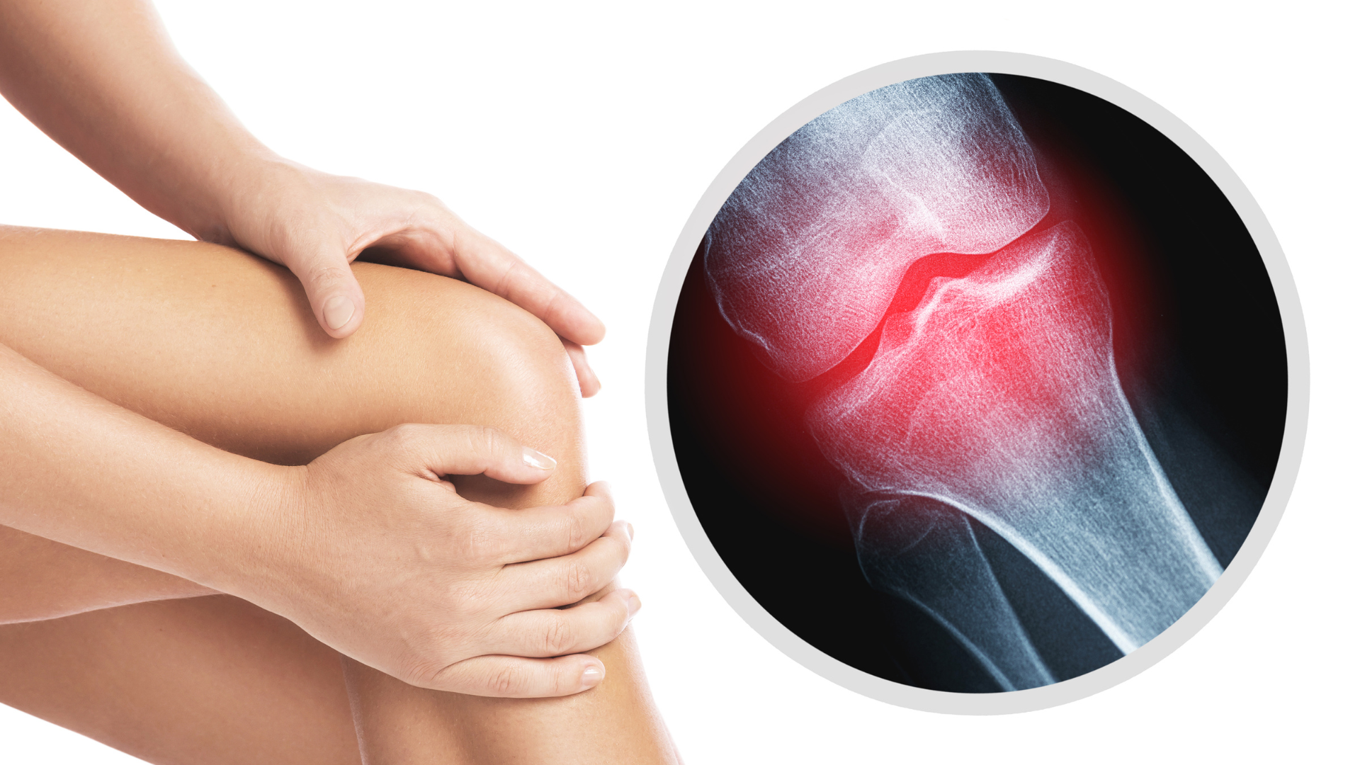 Knee pain. 